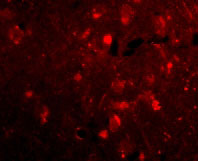 IF - Slitrk2 Antibody ASC10638