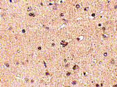 IHC - Slitrk2 Antibody ASC10638
