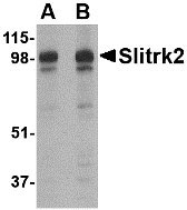 WB - Slitrk2 Antibody ASC10638