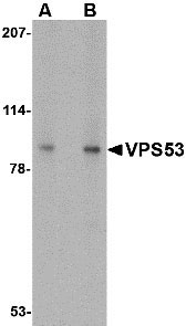 WB - VPS53 Antibody ASC10687