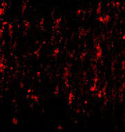 IF - SATB2 Antibody ASC10703