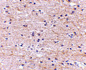 IHC - SATB2 Antibody ASC10703