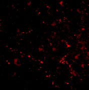 IF - SATB2 Antibody ASC10704