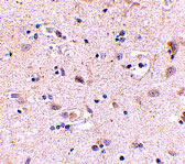 IHC - SATB2 Antibody ASC10704