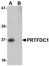 WB - PRTFDC1 Antibody ASC10754