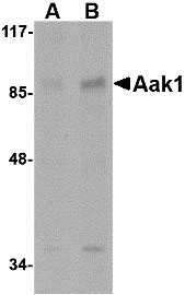 WB - Aak1 Antibody ASC10777