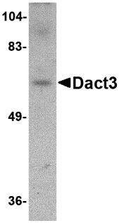 WB - Dact3 Antibody ASC10793