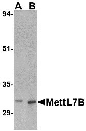 WB - MettL7B Antibody ASC10796