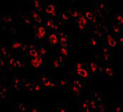 IF - PCDH18 Antibody ASC10870