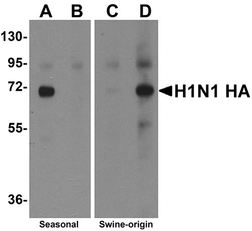 WB - Seasonal H1N1 Hemagglutinin Antibody ASC10928