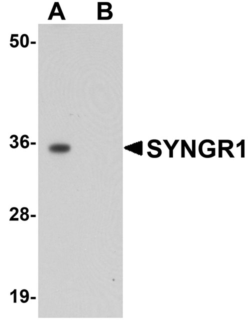 WB - SYNGR1 Antibody ASC11046