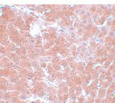 IHC - TMEM70 Antibody ASC11085
