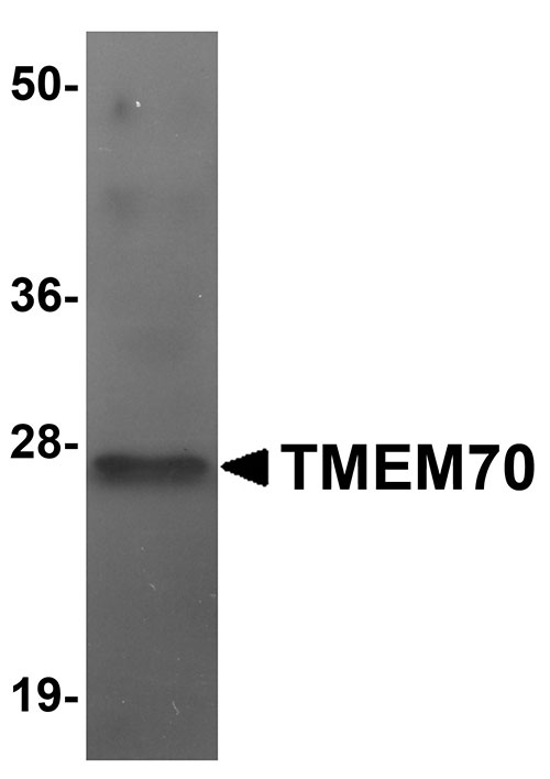 WB - TMEM70 Antibody ASC11085