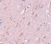 IHC - ZC3H12B Antibody ASC11099