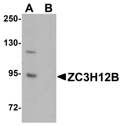 WB - ZC3H12B Antibody ASC11099