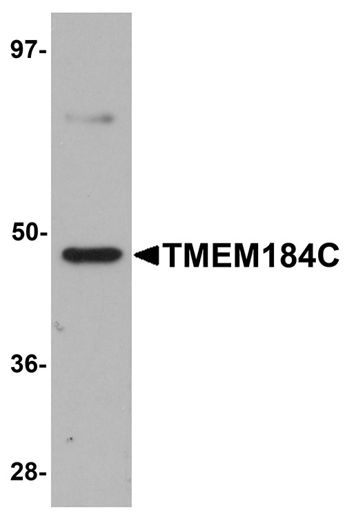WB - TMEM184C Antibody ASC11104