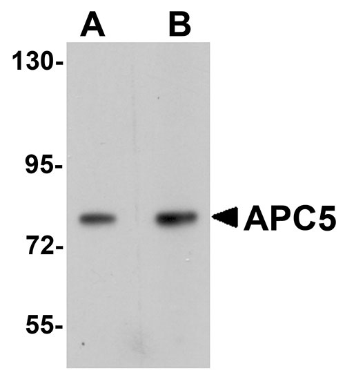 WB - APC5 Antibody ASC11117