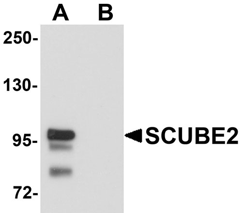 WB - SCUBE2 Antibody ASC11166