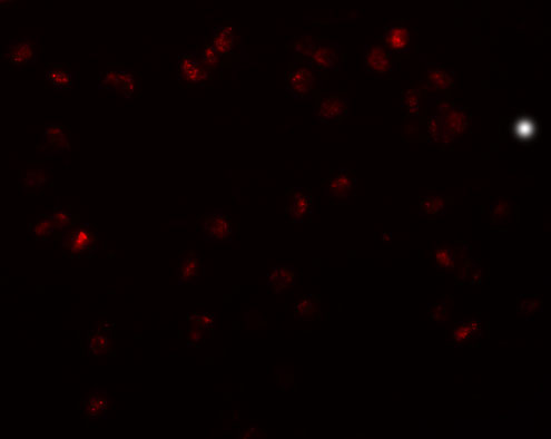 IF - TRIP6 Antibody ASC11215