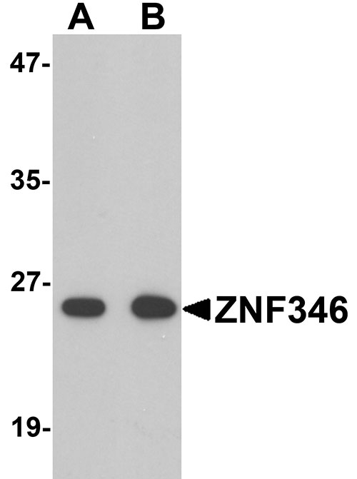 WB - ZNF346 Antibody ASC11216