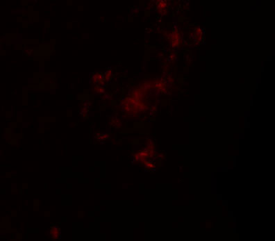 IF - ZBTB5 Antibody ASC11262
