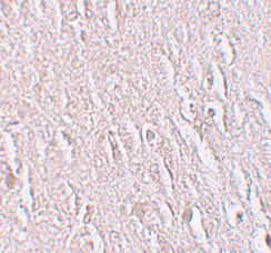IHC - ZBTB5 Antibody ASC11262