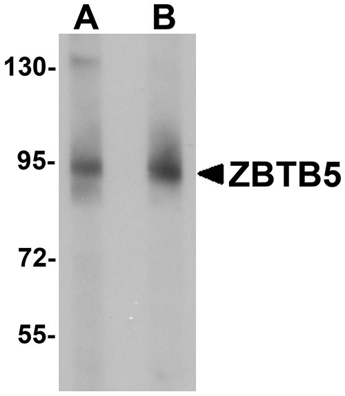 WB - ZBTB5 Antibody ASC11262