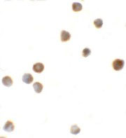 ICC - ZBTB6 Antibody ASC11263