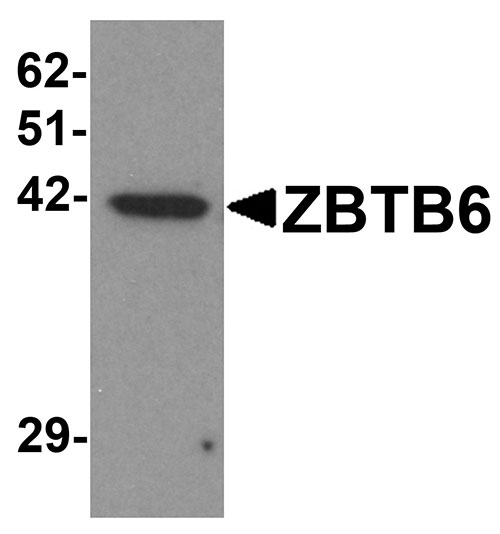 WB - ZBTB6 Antibody ASC11263