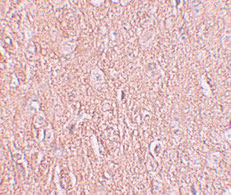 IHC - LRRTM2 Antibody ASC11275