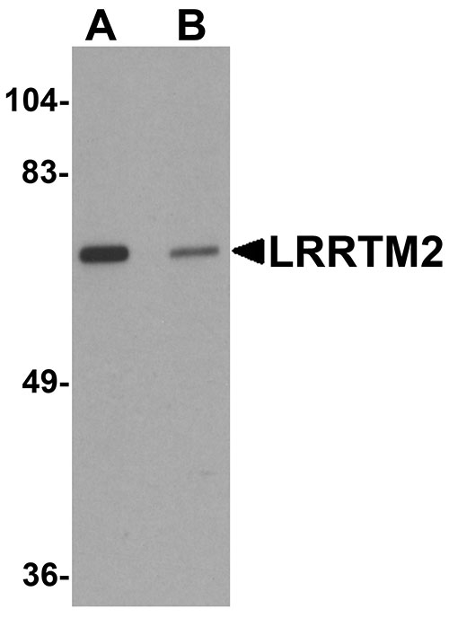WB - LRRTM2 Antibody ASC11275