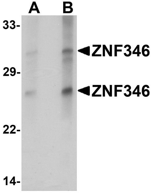 WB - ZNF346 (CT) Antibody ASC11287