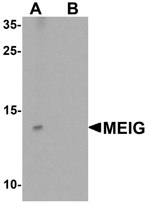 WB - MEIG1 Antibody ASC11337