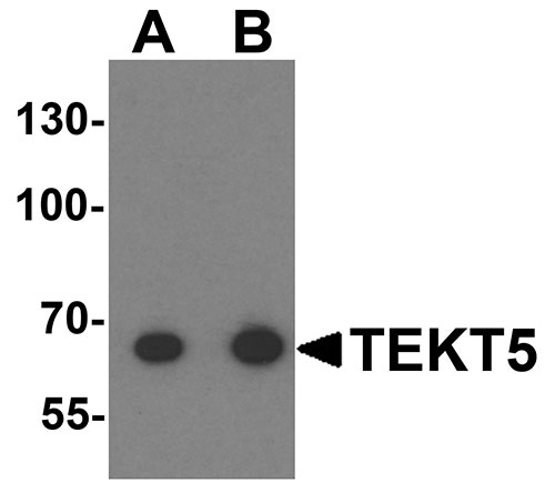 WB - TEKT5 Antibody ASC11338