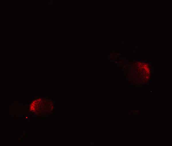 IF - AP3B2 Antibody ASC11344