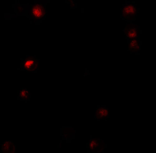 IF - Thymopoietin Antibody ASC11407