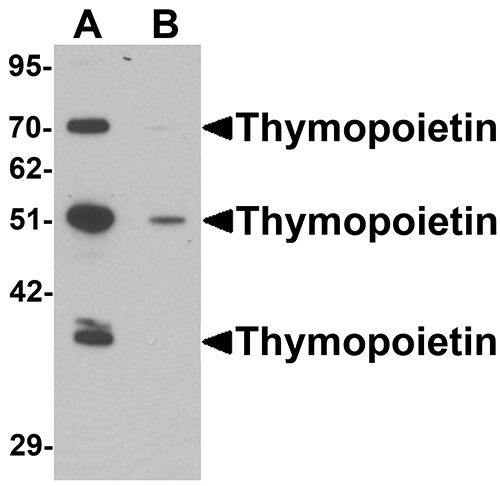 WB - Thymopoietin Antibody ASC11407