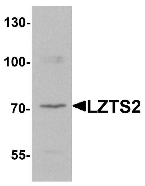 WB - LZTS2 Antibody ASC11420