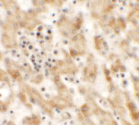 IHC - NKX2-8 Antibody ASC11449