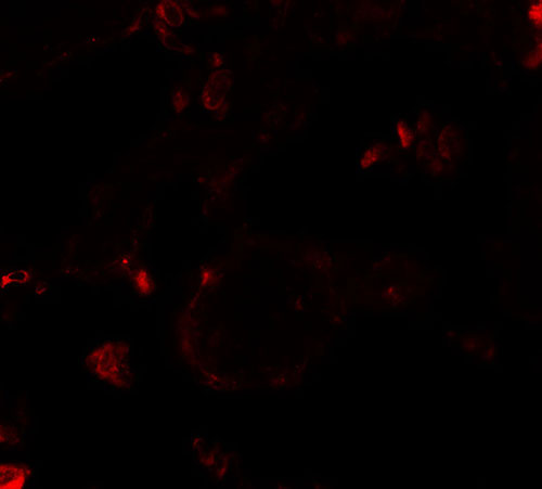 IF - VKORC1 Antibody ASC11468