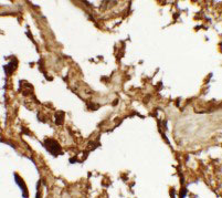 IHC - VKORC1 Antibody ASC11468