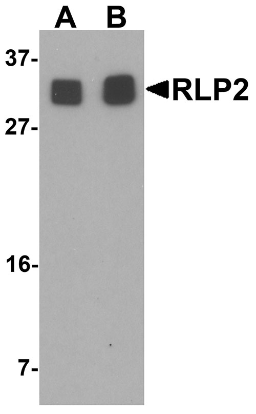 WB - RLP2 Antibody ASC11469