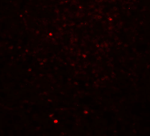 IF - CLEC7A Antibody ASC11480