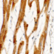 IHC - FCHO2 Antibody ASC11488