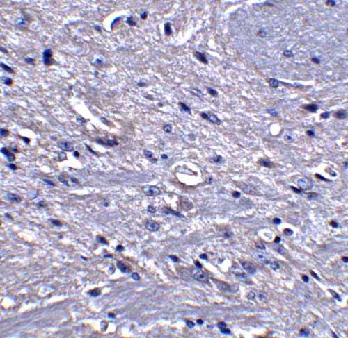 IHC - ABCA7 Antibody ASC11494