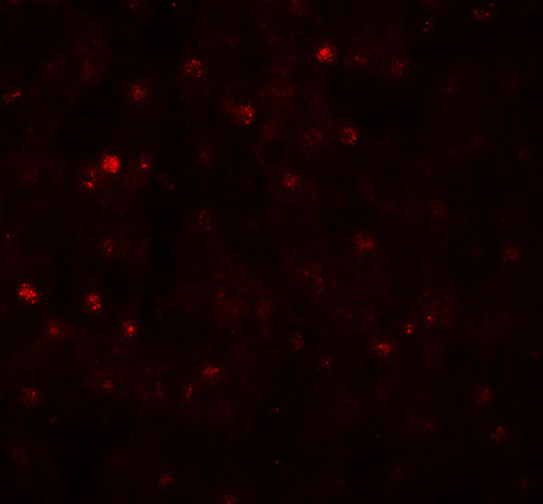 IF - TCTEX1D4 Antibody ASC11519