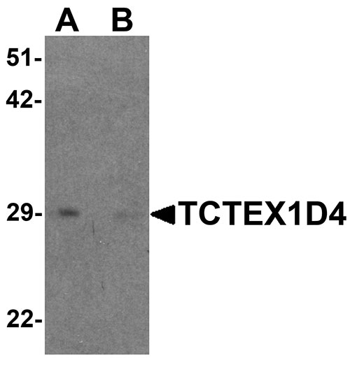 WB - TCTEX1D4 Antibody ASC11519