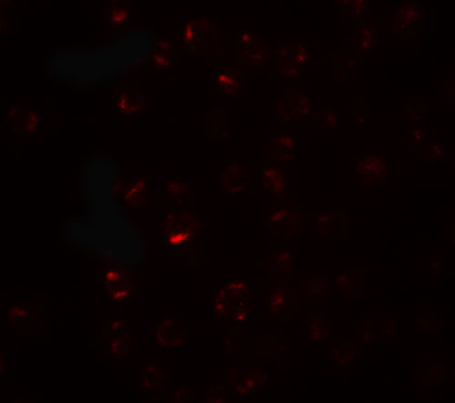 IF - CLEC2A Antibody ASC11520