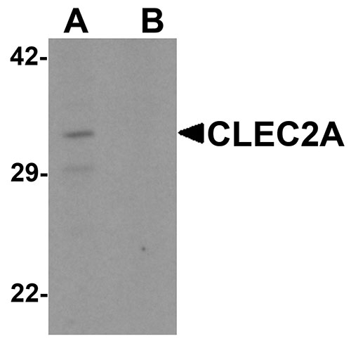 WB - CLEC2A Antibody ASC11520