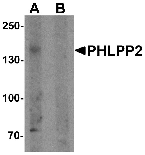 WB - PHLPP2 Antibody ASC11541
